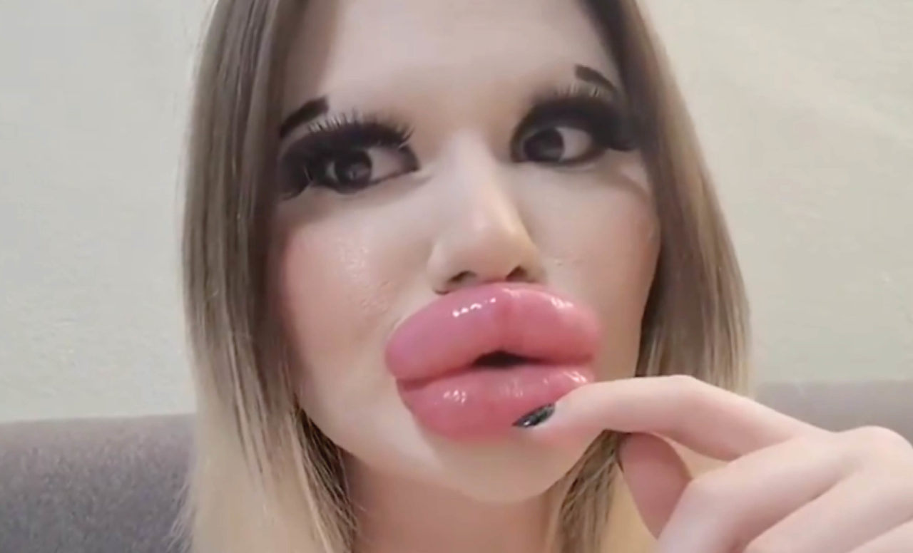 Una mujer con labios grandes