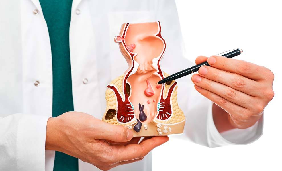 Un médico sosteniendo un bolígrafo y un modelo de cuerpo humano para consulta médica.