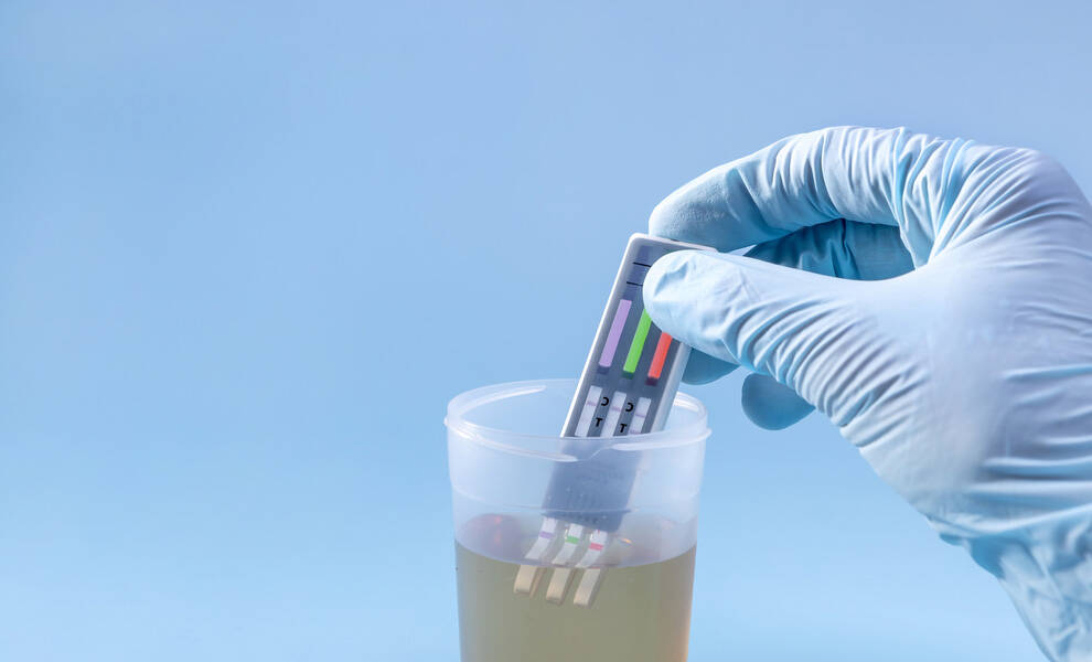 Una mano enguantada introduce tiras reactivas en un frasco de orina para detectar drogas ilegales y alcohol en el cuerpo humano.